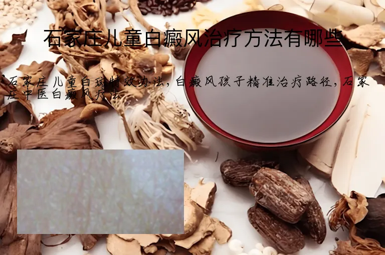石家庄儿童白癜风治疗方法有哪些