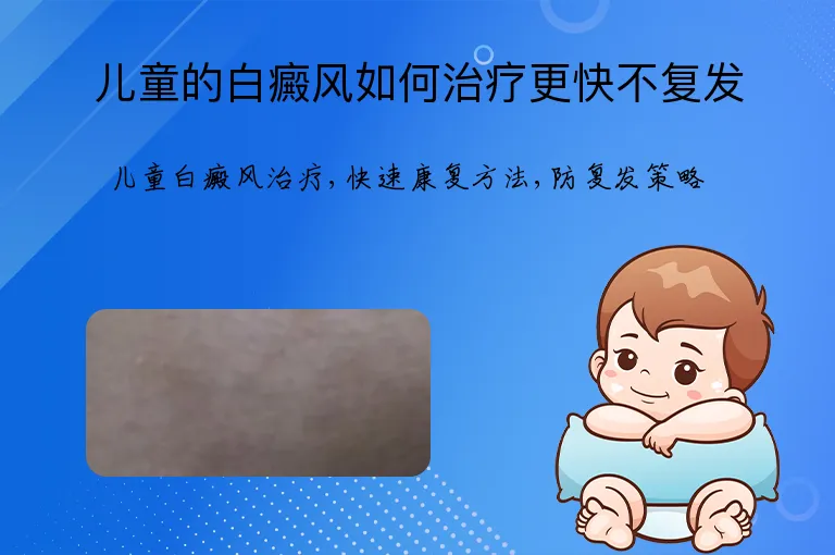 儿童的白癜风如何治疗更快不复发