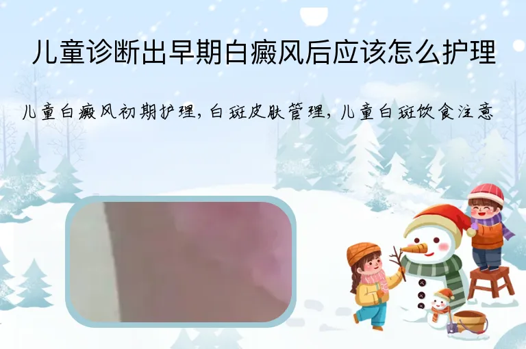 儿童诊断出早期白癜风后应该怎么护理