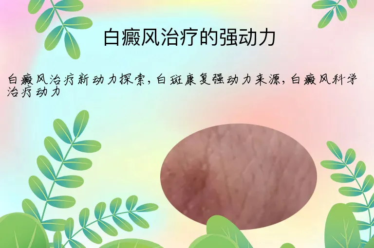 白癜风治疗的强动力