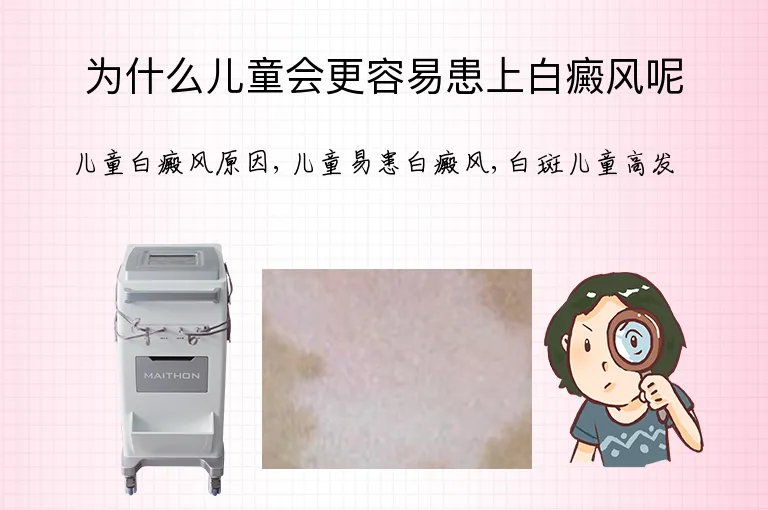 为什么儿童会更容易患上白癜风呢