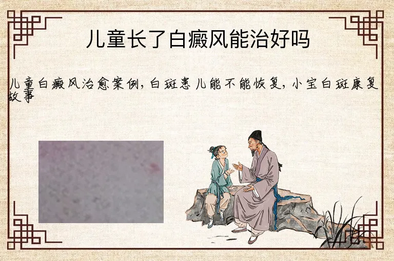 儿童长了白癜风能治好吗