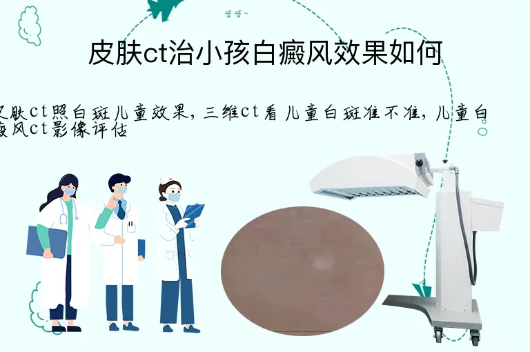 皮肤ct治小孩白癜风效果如何