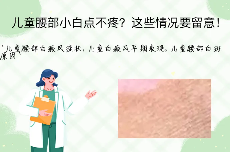 儿童腰部小白点不疼?这些情况要留意!