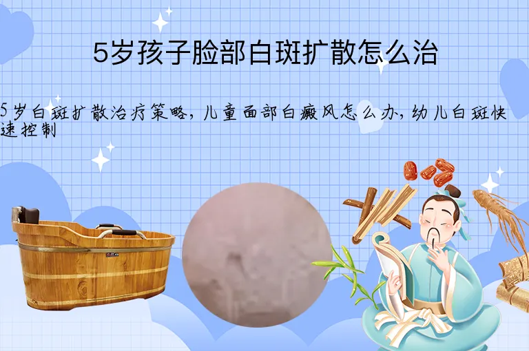 5岁孩子脸部白斑扩散怎么治