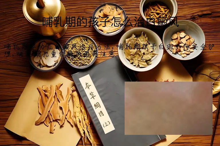 哺乳期的孩子怎么治白癜风
