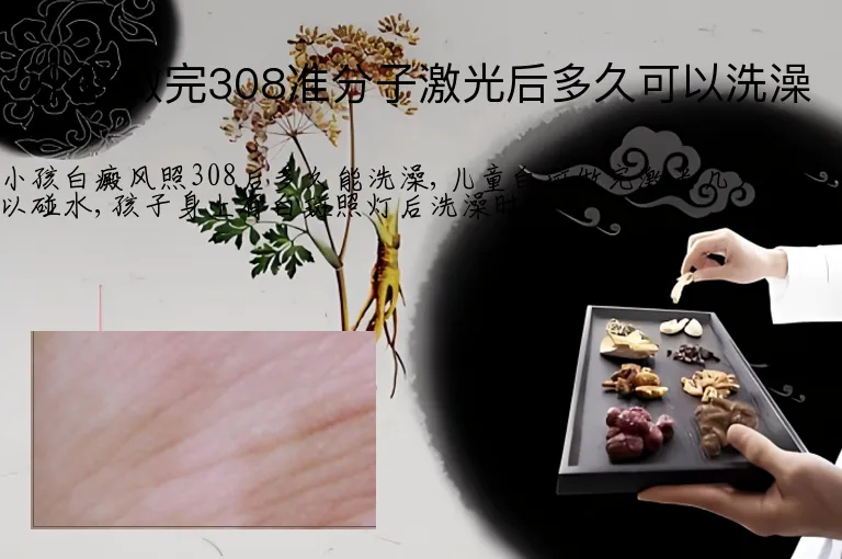 小孩做完308准分子激光后多久可以洗澡