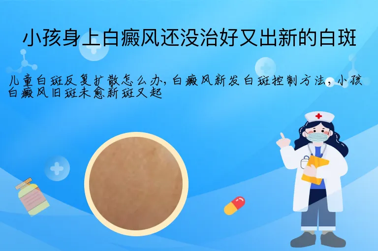 小孩身上白癜风还没治好又出新的白斑
