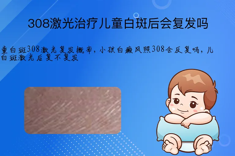 308激光治疗儿童白斑后会复发吗