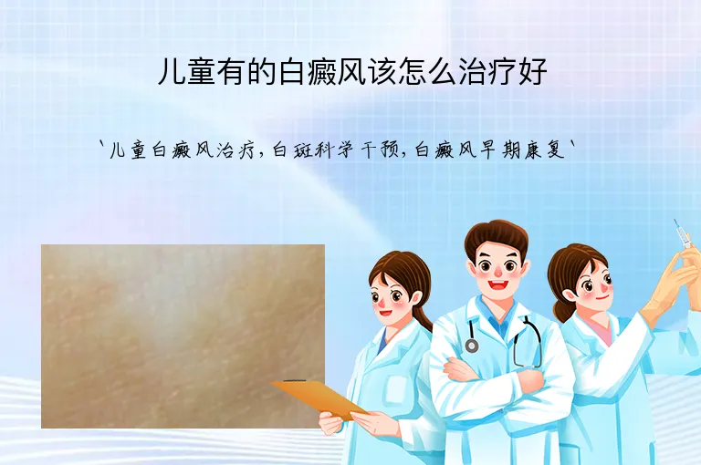 儿童有的白癜风该怎么治疗好
