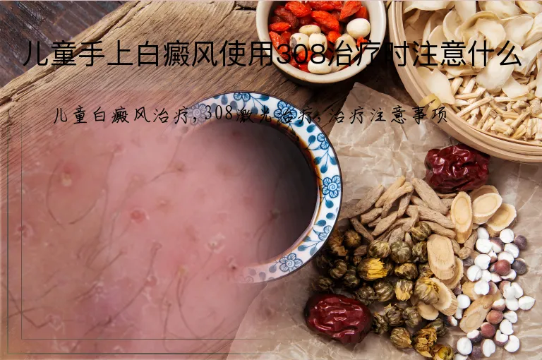 儿童手上白癜风使用308治疗时注意什么