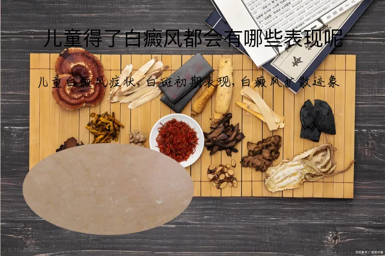 儿童得了白癜风都会有哪些表现呢
