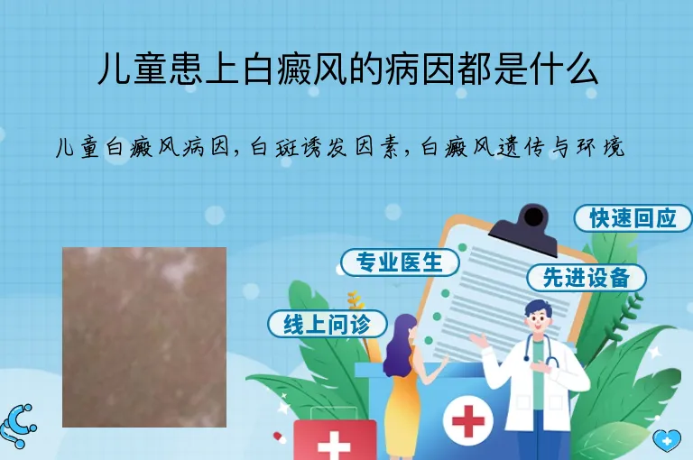 儿童患上白癜风的病因都是什么