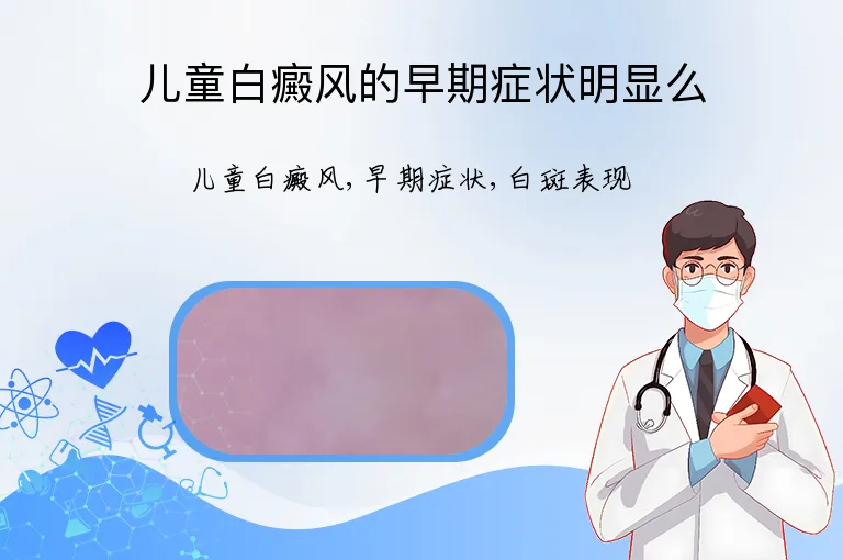 儿童白癜风的早期症状明显么