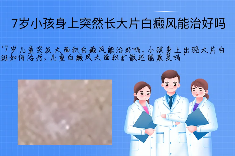 7岁小孩身上突然长大片白癜风能治好吗