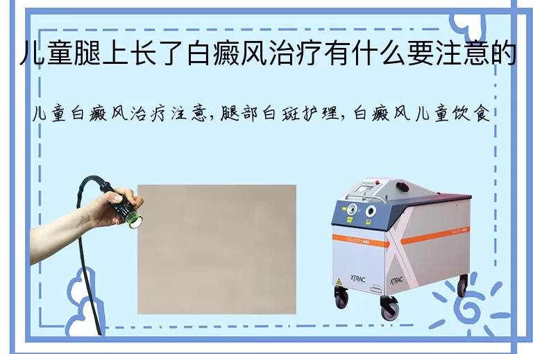 儿童腿上长了白癜风治疗有什么要注意的