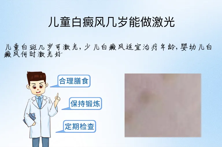 儿童白癜风几岁能做激光