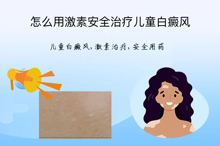 怎么用激素安全治疗儿童白癜风