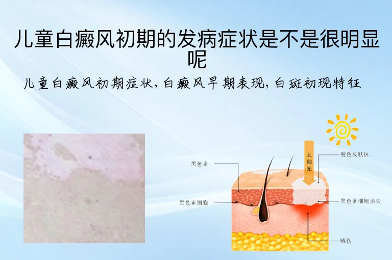 儿童白癜风初期的发病症状是不是很明显呢