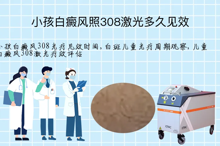 小孩白癜风照308激光多久见效
