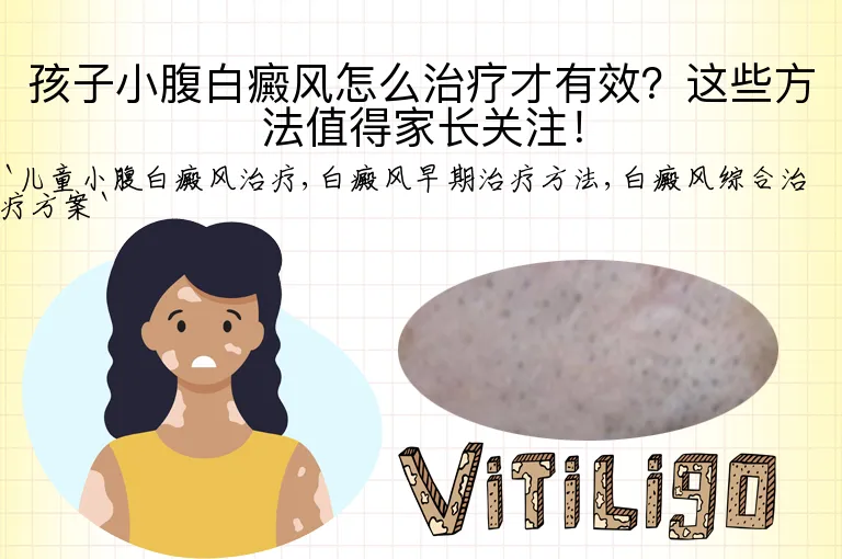 孩子小腹白癜风怎么治疗才有效？这些方法值得家长关注！