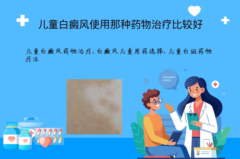 儿童白癜风使用那种药物治疗比较好