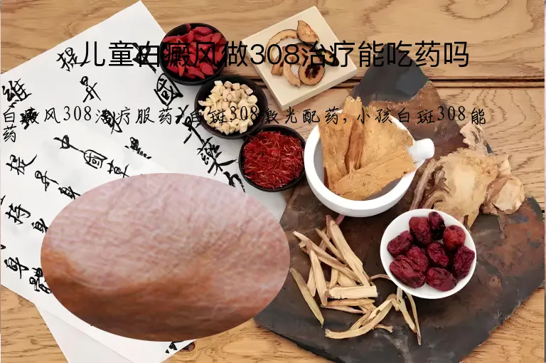 儿童白癜风做308治疗能吃药吗