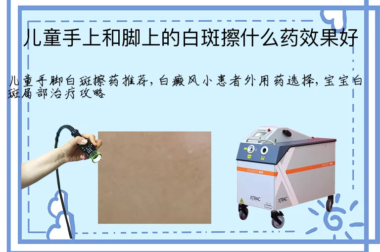 儿童手上和脚上的白斑擦什么药效果好