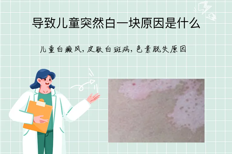 导致儿童突然白一块原因是什么