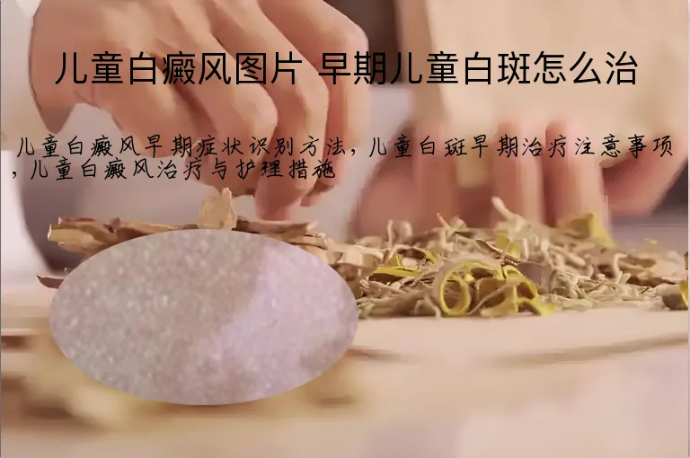 儿童白癜风图片 早期儿童白斑怎么治