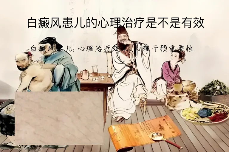 白癜风患儿的心理治疗是不是有效