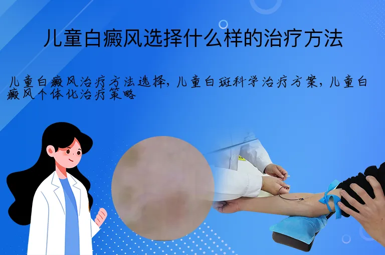 儿童白癜风选择什么样的治疗方法