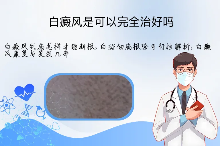 白癜风是可以完全治好吗