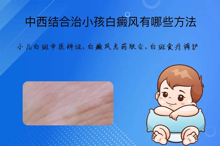中西结合治小孩白癜风有哪些方法