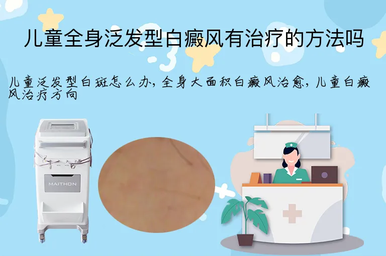 儿童全身泛发型白癜风有治疗的方法吗