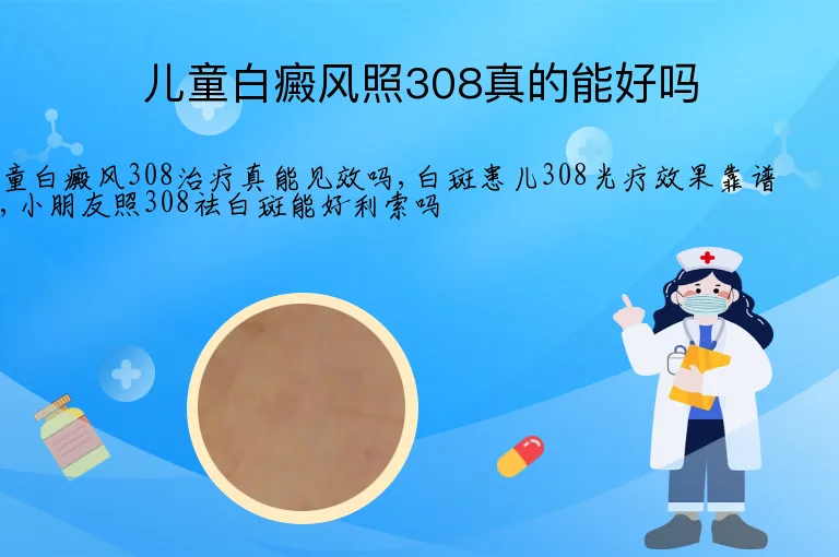 儿童白癜风照308真的能好吗