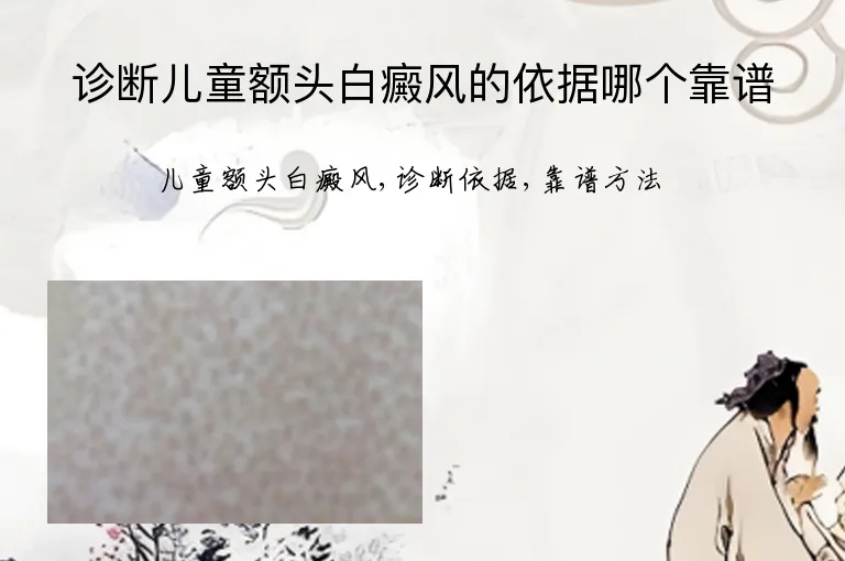 诊断儿童额头白癜风的依据哪个靠谱