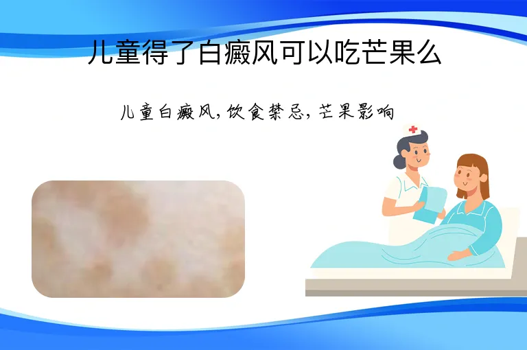 儿童得了白癜风可以吃芒果么