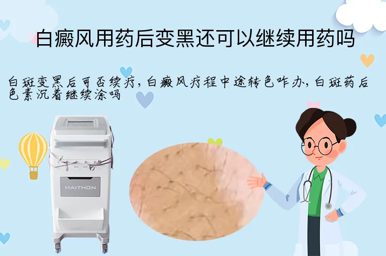 白癜风用药后变黑还可以继续用药吗