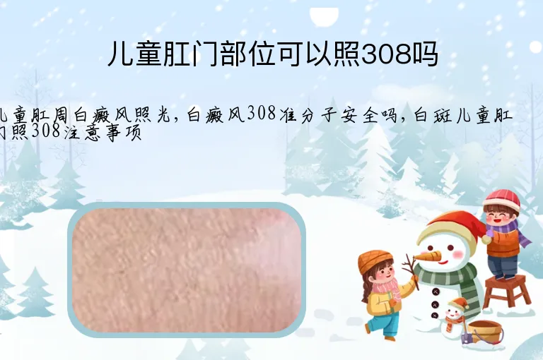 儿童肛门部位可以照308吗