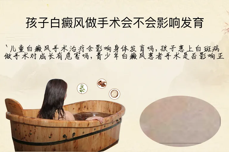 孩子白癜风做手术会不会影响发育