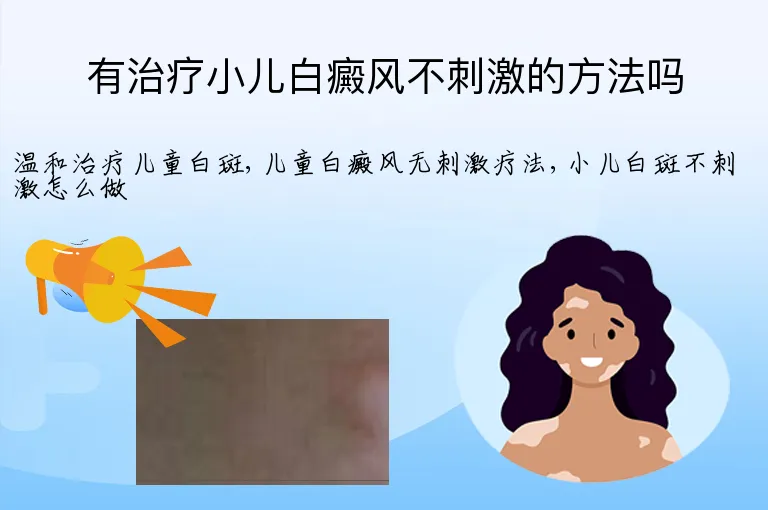 有治疗小儿白癜风不刺激的方法吗