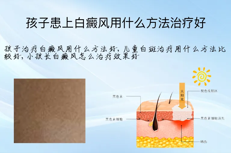孩子患上白癜风用什么方法治疗好