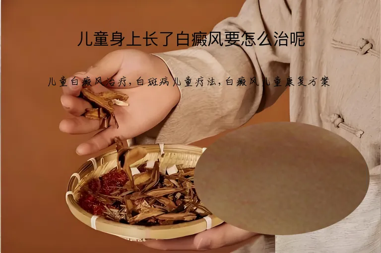 儿童身上长了白癜风要怎么治呢