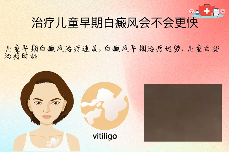 治疗儿童早期白癜风会不会更快