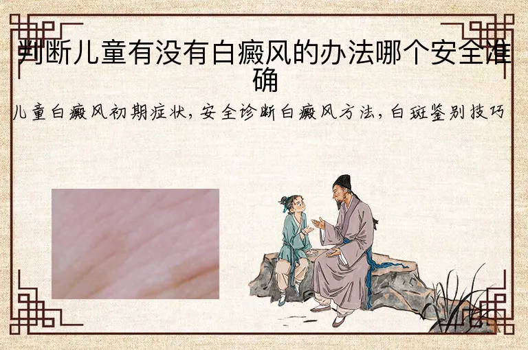 判断儿童有没有白癜风的办法哪个安全准确