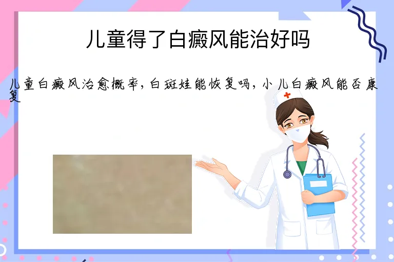 儿童得了白癜风能治好吗