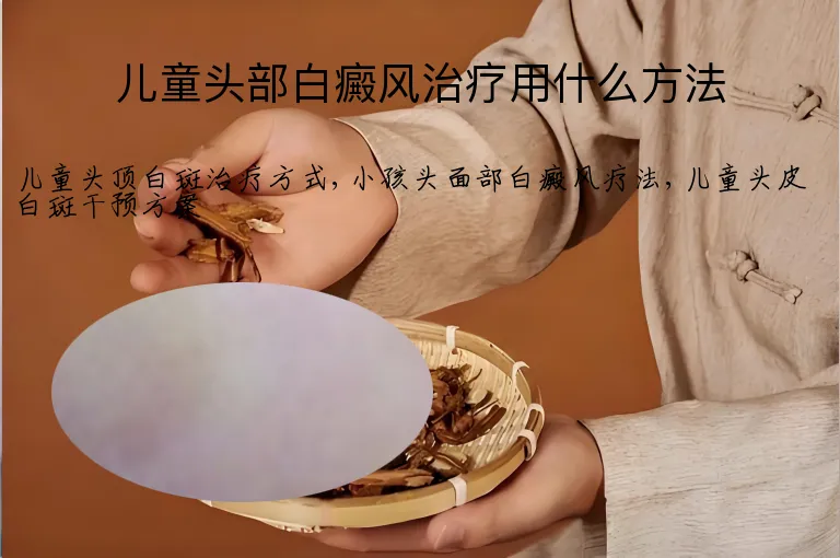 儿童头部白癜风治疗用什么方法