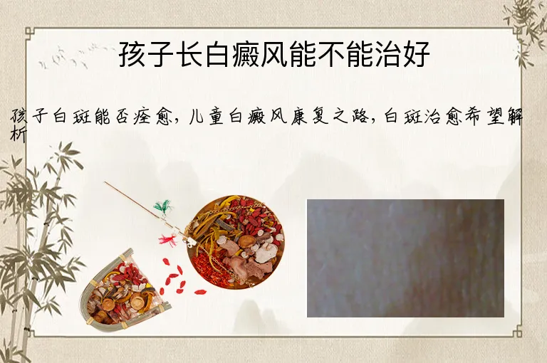 孩子长白癜风能不能治好