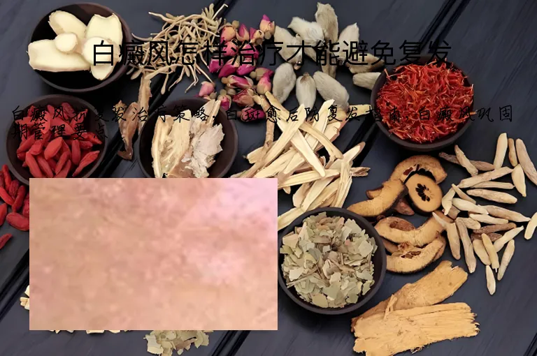 白癜风怎样治疗才能避免复发